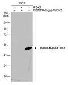 Anti-PDK2 antibody [N2C3] used in Western Blot (WB). GTX105251