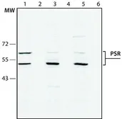 Anti-PSR antibody used in Western Blot (WB). GTX10526