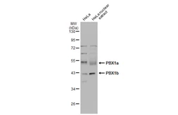 Anti-PBX1 antibody [N2C3] used in Western Blot (WB). GTX105260