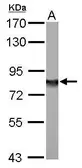 Anti-NDUFS1 antibody used in Western Blot (WB). GTX105270
