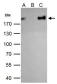 Anti-ZEB1 antibody [N2C1], Internal used in Immunoprecipitation (IP). GTX105278