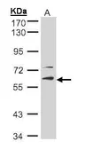Anti-STK33 antibody [N1C1] used in Western Blot (WB). GTX105293