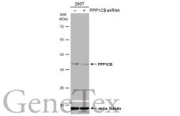 Anti-PPP1CB antibody used in Western Blot (WB). GTX105295