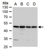 Anti-Annexin VII antibody used in Western Blot (WB). GTX105298