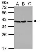 Anti-POU6F1 antibody used in Western Blot (WB). GTX105299