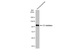 Anti-C1 inhibitor antibody [N1C3] used in Western Blot (WB). GTX105316