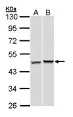 Anti-PSMC5 antibody used in Western Blot (WB). GTX105347