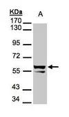 Anti-Cytokeratin 6 antibody used in Western Blot (WB). GTX105355