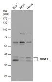 Anti-SUGT1 antibody [N1C3] used in Western Blot (WB). GTX105358