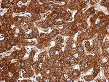 Anti-LSS antibody used in IHC (Paraffin sections) (IHC-P). GTX105363