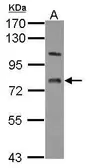Anti-LSS antibody used in Western Blot (WB). GTX105363