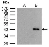 Anti-BRCC45 antibody used in Immunoprecipitation (IP). GTX105364