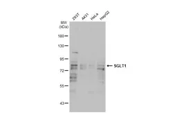 Anti-SGLT1 antibody [N3C3] used in Western Blot (WB). GTX105367