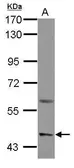 Anti-ASIC1 antibody [N1C2] used in Western Blot (WB). GTX105373