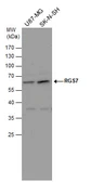 Anti-RGS7 antibody used in Western Blot (WB). GTX105382