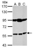 Anti-Bestrophin 1 antibody used in Western Blot (WB). GTX105387