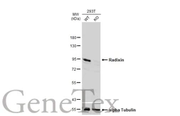 Anti-Radixin antibody used in Western Blot (WB). GTX105408