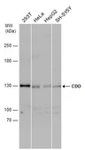 Anti-CDON / CDO antibody [N1N2], N-term used in Western Blot (WB). GTX105422