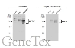 Anti-MEF2C antibody used in Western Blot (WB). GTX105433