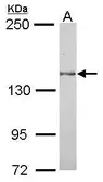 Anti-MAP4K6 antibody [C1C3] used in Western Blot (WB). GTX105449