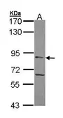 Anti-APEH antibody used in Western Blot (WB). GTX105450