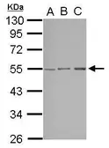 Anti-STK38L antibody [N1C2] used in Western Blot (WB). GTX105451