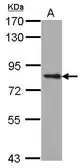 Anti-PKC epsilon antibody [N2C2], Internal used in Western Blot (WB). GTX105452