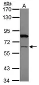 Anti-ZNF449 antibody used in Western Blot (WB). GTX105470