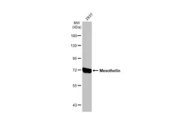 Anti-Mesothelin antibody [N1C2] used in Western Blot (WB). GTX105471