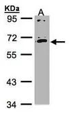 Anti-IL17 Receptor C antibody [N1C1] used in Western Blot (WB). GTX105487