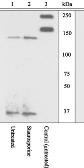 Anti-ROCK1 antibody used in Western Blot (WB). GTX10549