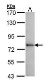 Anti-DDX41 antibody used in Western Blot (WB). GTX105502