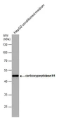 Anti-CPN1 antibody [N1C3] used in Western Blot (WB). GTX105515
