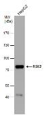 Anti-RSK2 antibody used in Western Blot (WB). GTX105543