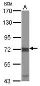 Anti-IKK epsilon antibody [N2C3] used in Western Blot (WB). GTX105547