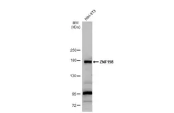 Anti-ZNF198 antibody used in Western Blot (WB). GTX105550