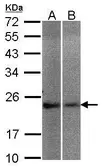 Anti-NCS1 antibody used in Western Blot (WB). GTX105552