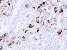 Anti-Carbonic Anhydrase II antibody [N1C3] used in IHC (Paraffin sections) (IHC-P). GTX105562