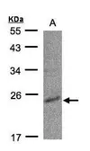 Anti-CMPK1 antibody [N1C3] used in Western Blot (WB). GTX105566