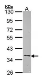 Anti-Ephrin B2 antibody [N1C1] used in Western Blot (WB). GTX105582