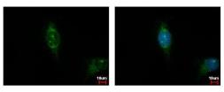 Anti-Casein Kinase 1 alpha 1L antibody used in Immunocytochemistry/ Immunofluorescence (ICC/IF). GTX105584