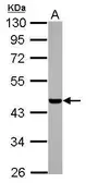Anti-Casein Kinase 1 alpha 1L antibody used in Western Blot (WB). GTX105584