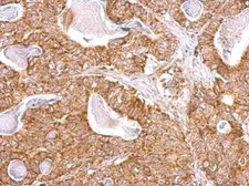 Anti-NDUFB9 antibody used in IHC (Paraffin sections) (IHC-P). GTX105590