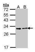 Anti-FKBP25 antibody [N1C3] used in Western Blot (WB). GTX105608