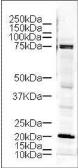 Anti-LIMK1 antibody used in Western Blot (WB). GTX10561