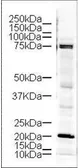 Anti-LIMK1 antibody used in Western Blot (WB). GTX10561