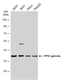 Anti-PP1C gamma antibody [N1C2] used in Western Blot (WB). GTX105618