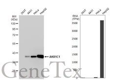Anti-AKR1C1 antibody used in Western Blot (WB). GTX105620