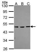 Anti-MBD2 antibody [N2C3] used in Western Blot (WB). GTX105622