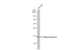 Anti-Ribonuclease A antibody used in Western Blot (WB). GTX105623